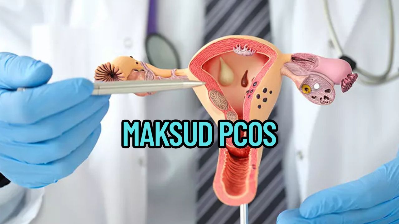 Maksud PCOS